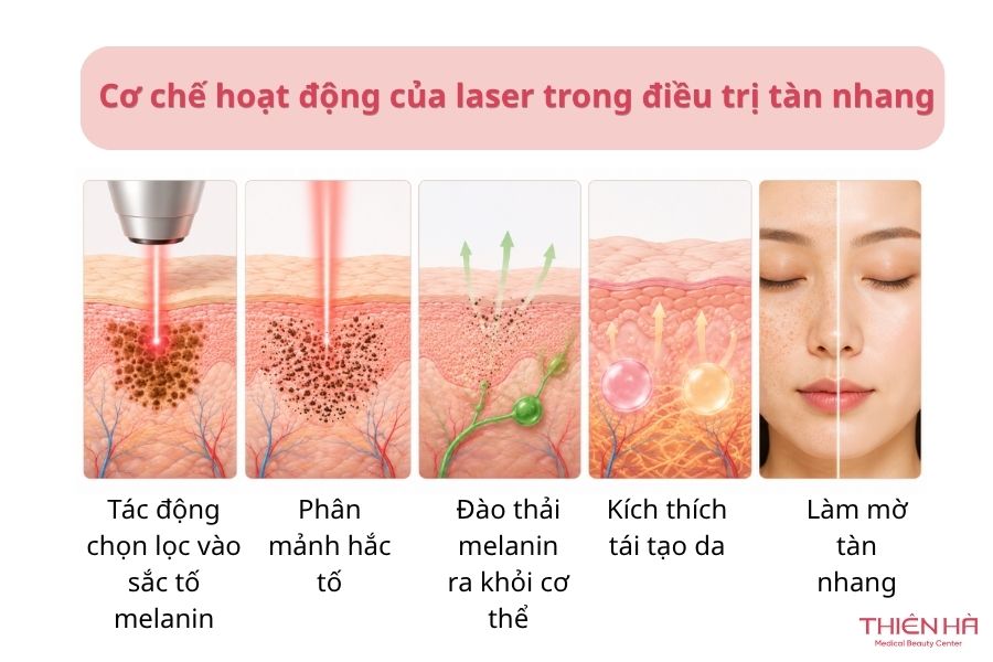 Bắn laser tàn nhang: Hiệu quả, chi phí và quy trình 2 Cơ chế hoạt động của laser trong điều trị tàn nhang