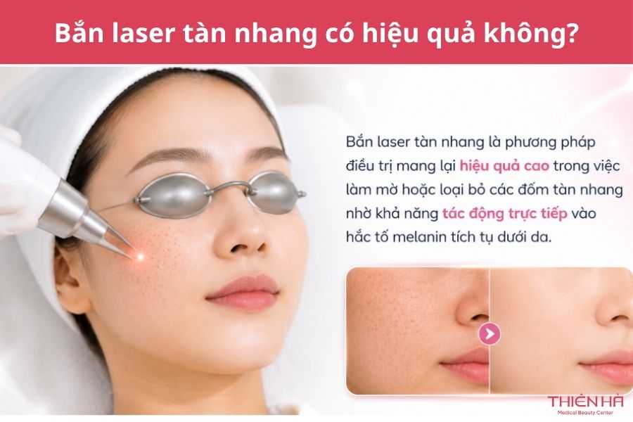 Bắn laser tàn nhang: Hiệu quả, chi phí và quy trình 3 Bắn laser tàn nhang có hiệu quả không?