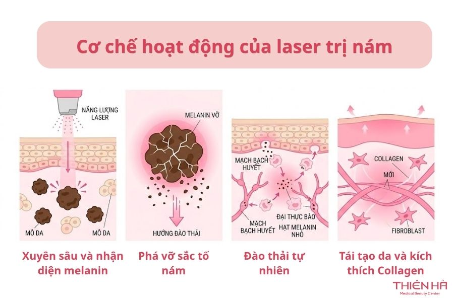 Cơ chế hoạt động của laser trị nám 