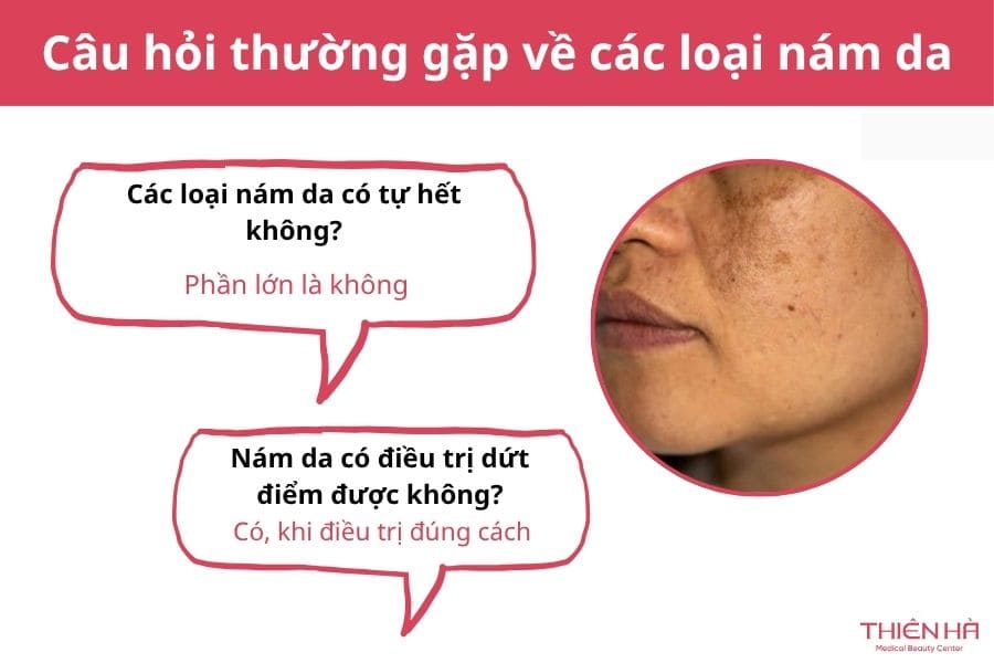 Câu hỏi thường gặp về các loại nám da