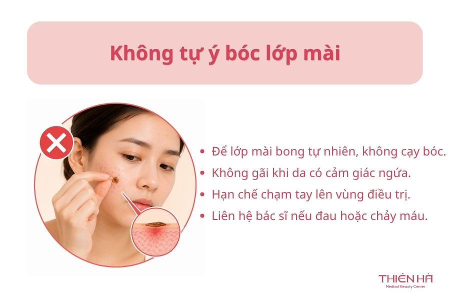 Không tự ý bóc lớp mài