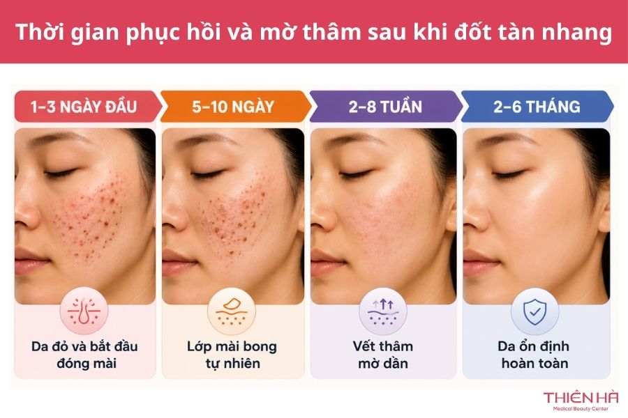 Thời gian phục hồi và mờ thâm sau khi đốt tàn nhang