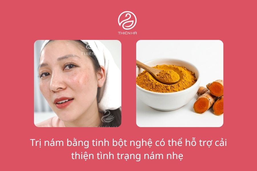 Cách đắp mặt nạ tinh bột nghệ trị nám hiệu quả tại nhà 1 Trị nám bằng tinh bột nghệ có hiệu quả hay không ?