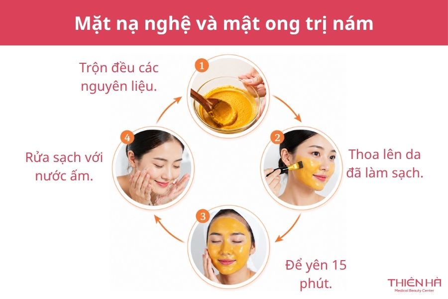 Cách đắp mặt nạ tinh bột nghệ trị nám hiệu quả tại nhà 3 Đắp mặt nạ tinh bột nghệ và mật ong trị nám giúp kháng khuẩn, mờ thâm