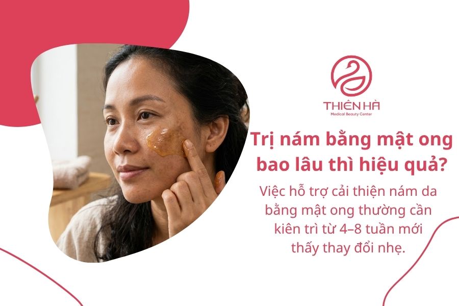 Câu hỏi về cách trị nám bằng mật ong