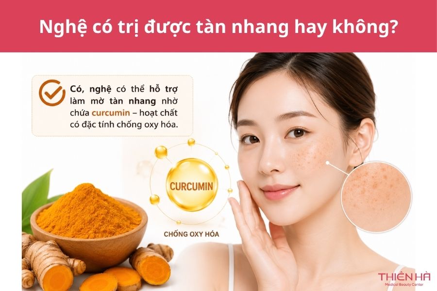 Cách trị tàn nhang bằng nghệ: 5 công thức đơn giản, hiệu quả 1 Nghệ có trị tàn nhang được không?