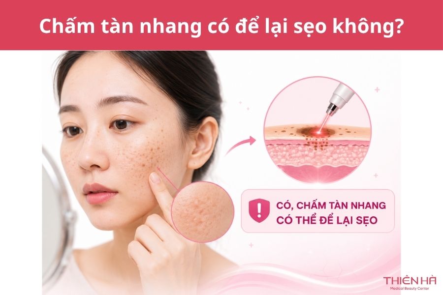 Chấm tàn nhang là gì? Có sẹo không và giá bao nhiêu 3 Chấm tàn nhang có để lại sẹo không?