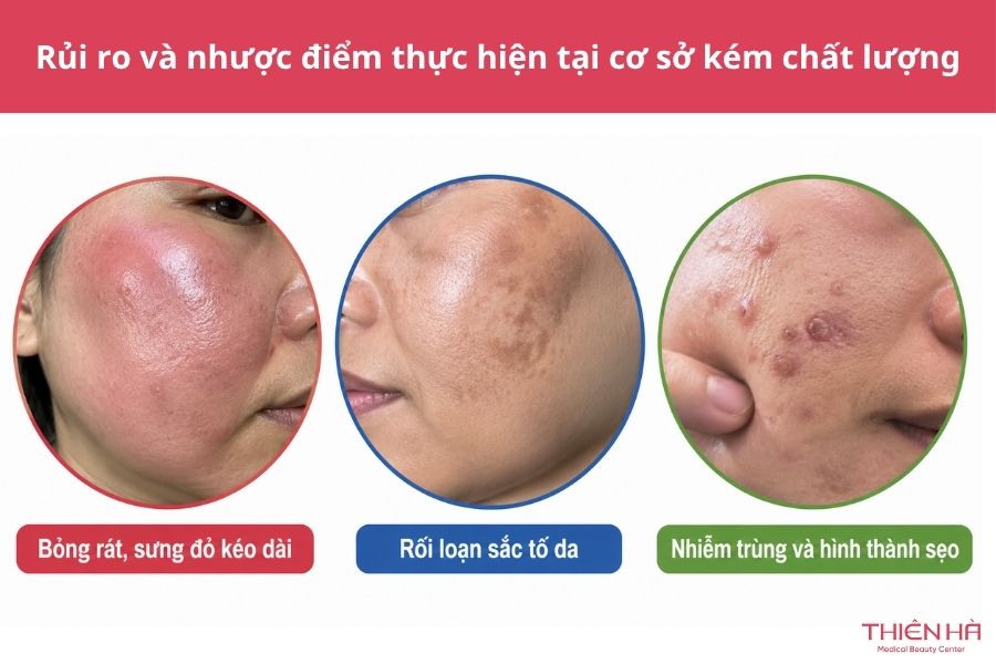 Rủi ro và nhược điểm nếu thực hiện tại cơ sở kém chất lượng
