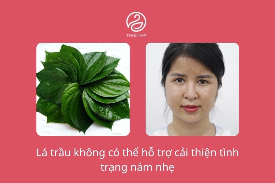 Điều trị nám bằng lá trầu không: Hướng dẫn từ A–Z hiệu quả 1 Lá trầu không trị nám có hiệu quả không?