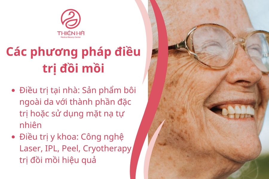 Dù chọn phương pháp nào, việc tham khảo ý kiến bác sĩ da liễu và chăm sóc da sau điều trị là rất quan trọng để đạt kết quả tối ưu và duy trì làn da khỏe mạnh.