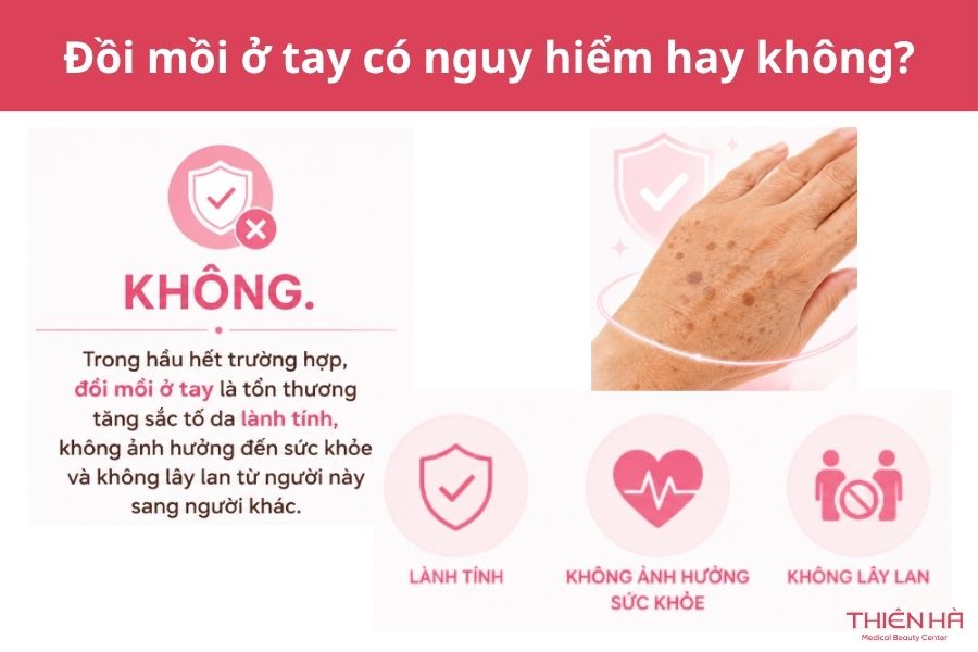 Đồi mồi ở tay: Nguyên nhân, có nguy hiểm không, cách trị 4 Đồi mồi ở tay có nguy hiểm không?