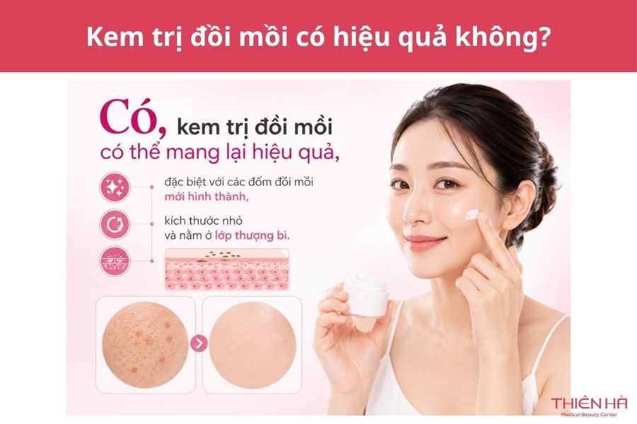 Kem trị đồi mồi có hiệu quả không? 