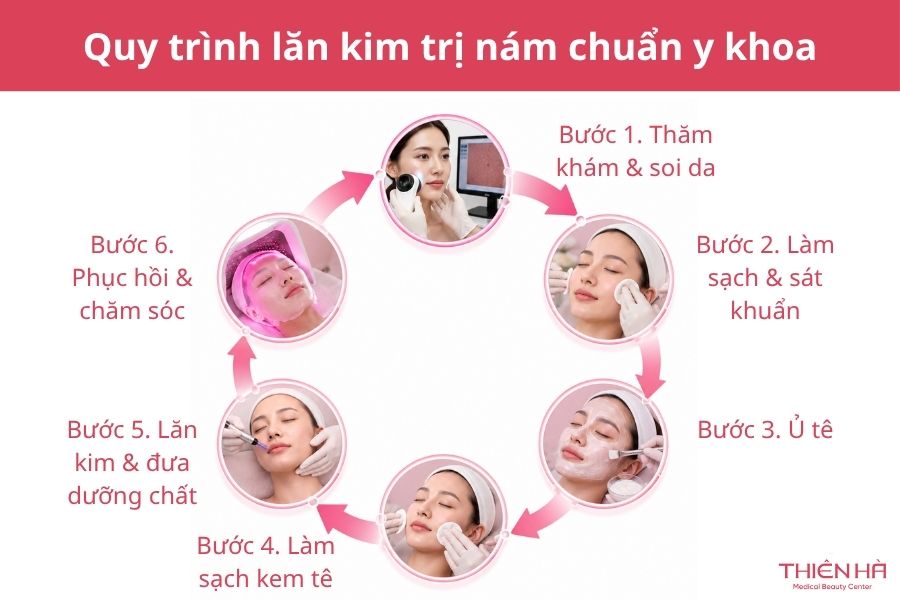 Quy trình lăn kim trị nám chuẩn y khoa 