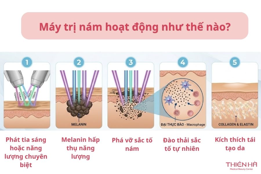 Máy trị nám hoạt động như thế nào?
