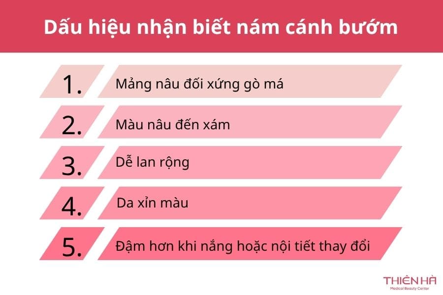 Dấu hiệu nhận biết nám cánh bướm 
