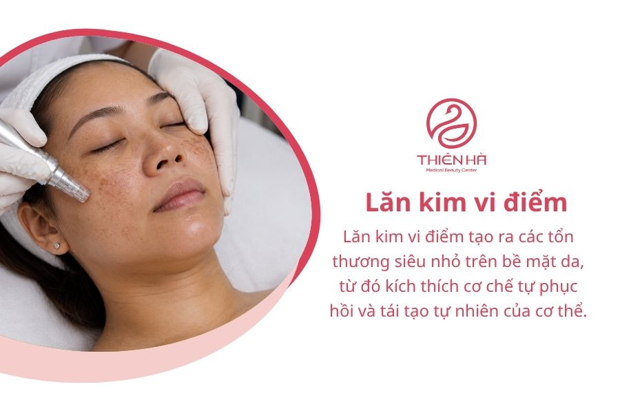 Lăn kim vi điểm
