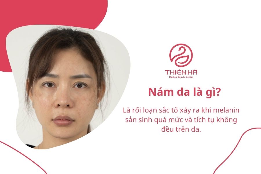 Nám da là gì?