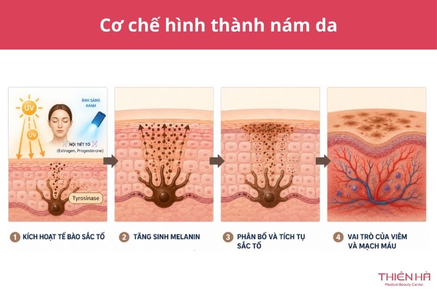 Cơ chế hình thành nám da