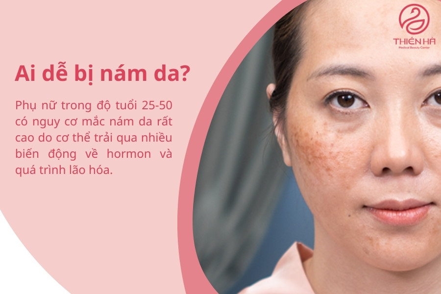 Cả nam và nữ giới đều có nguy cơ bị nám da nhưng tỷ lệ nữ giới mắc luôn cao hơn