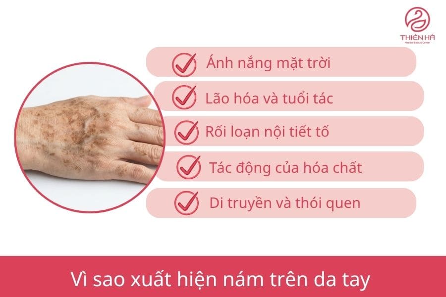 Vì sao xuất hiện vết nám trên da