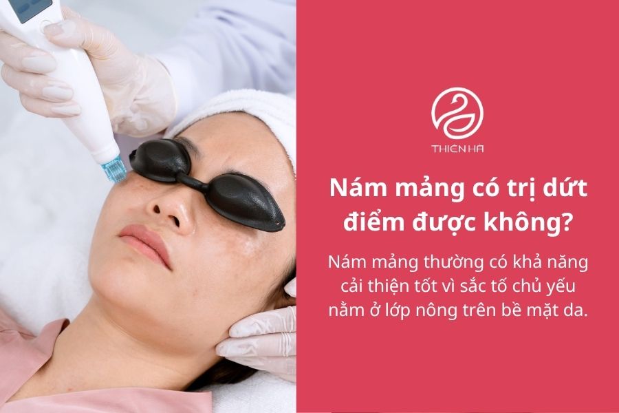 Câu hỏi thường gặp về nám mảng 