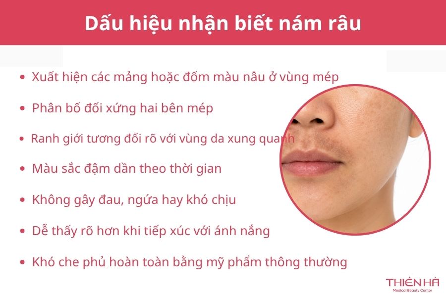 Có thể nhận biết nám râu dựa vào những dấu hiệu gì?