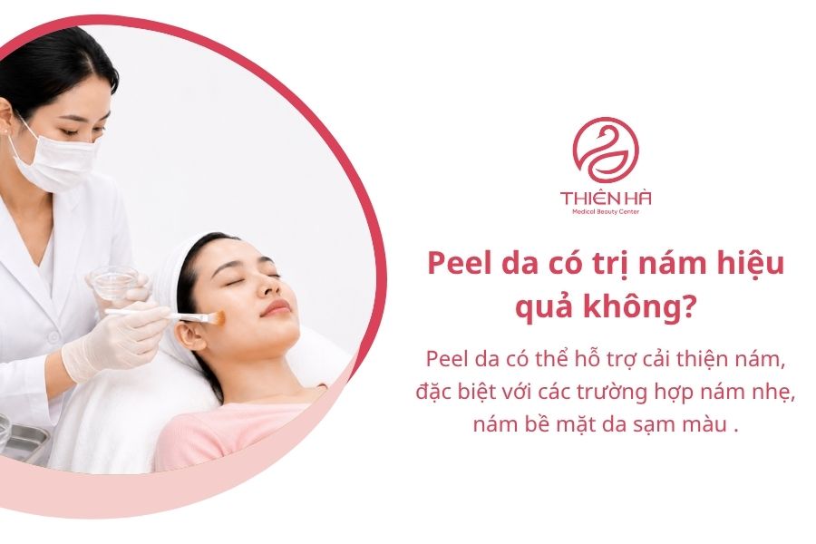 Peel da trị nám là gì? Tất cả thông tin về hiệu quả, giá cả 3 Peel da có trị nám hiệu quả không?