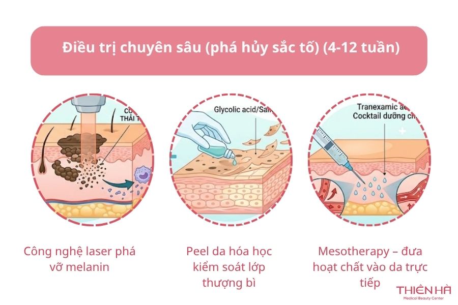 Giai đoạn 2: Điều trị chuyên sâu (phá hủy sắc tố) (4-12 tuần)