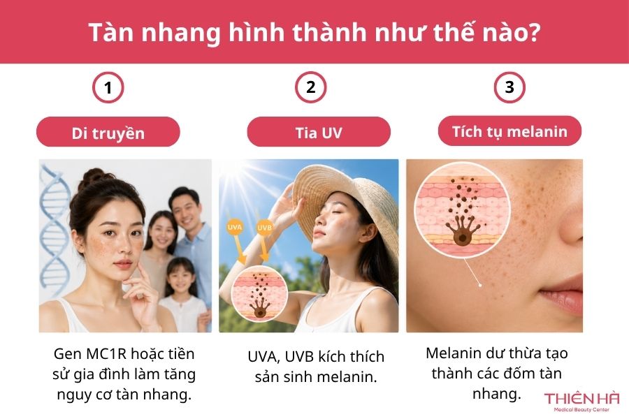 Tàn nhang hình thành như thế nào? 