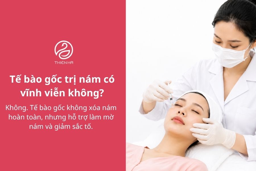 Tế bào gốc trị nám là gì? Hiệu quả và chi phí thực tế 10 Câu hỏi thường gặp về tế bào gốc trị nám
