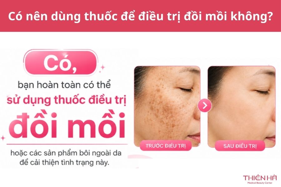 Có nên dùng thuốc để điều trị đồi mồi không?