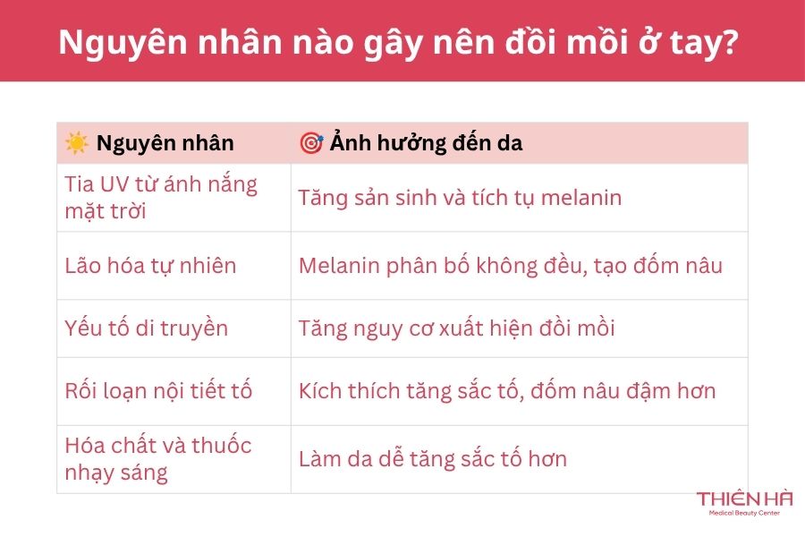 Nguyên nhân nào gây nên đồi mồi ở tay? 