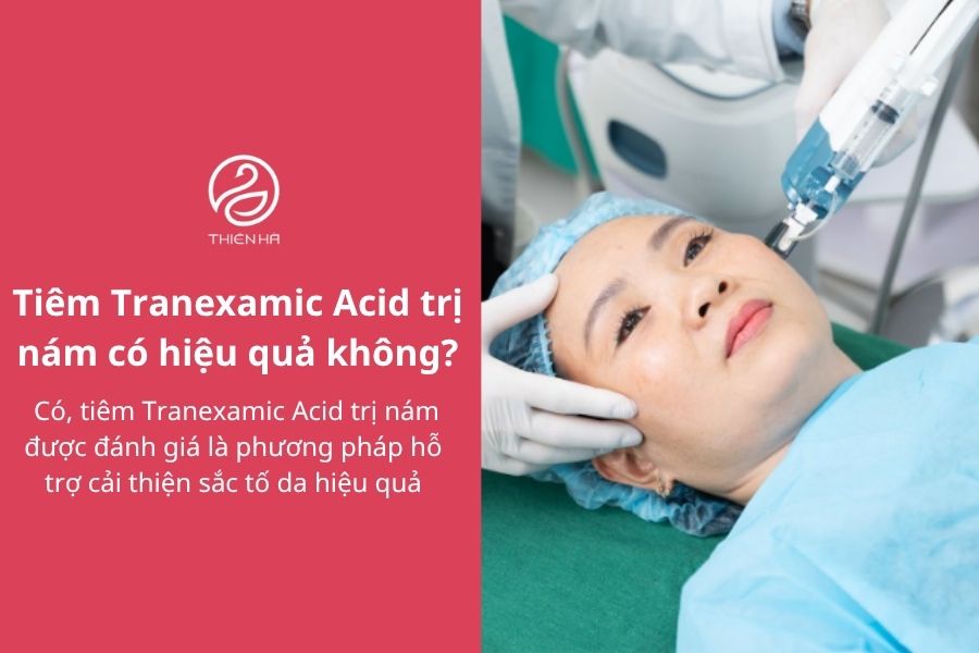 Tranexamic Acid tiêm nám: Hiệu quả, liều lượng và lưu ý 3 Tiêm Tranexamic Acid trị nám có hiệu quả không?