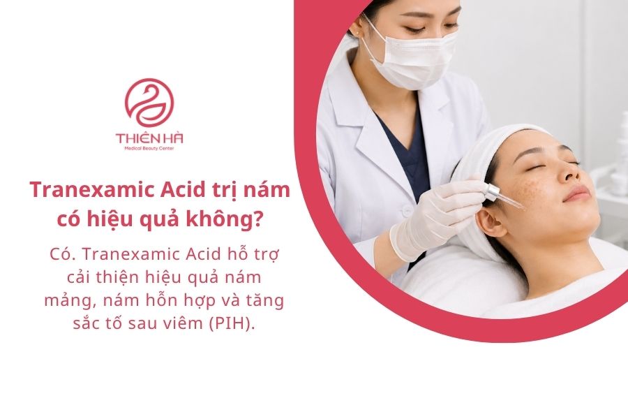 Tranexamic Acid trị nám có hiệu quả không?