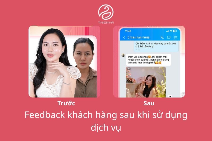Trẻ hóa da là gì? 10+ phương pháp trẻ hóa da mặt hiệu quả nhất 10 Tin nhắn feedback của chị Trâm Anh sau khi thực hiện trẻ hóa tại Thẩm mỹ viện Thiên Hà