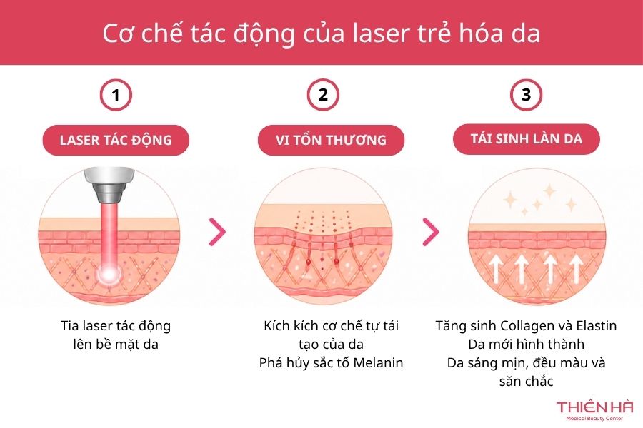 Trẻ Hóa Da Bằng Laser Có Tốt Không? Review Hiệu Quả 1 Cơ chế tác động của laser khi trẻ hóa da