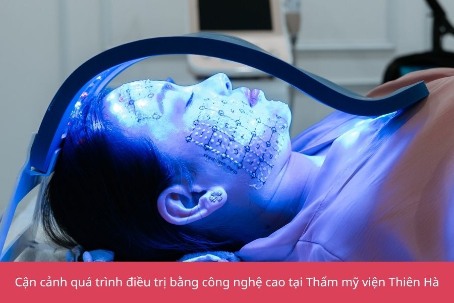 Trẻ hóa da ở đâu uy tín? Tiêu chí và địa chỉ trẻ hóa tốt tại Hà Nội 7 Cận cảnh công nghệ trẻ hóa da công nghệ cao tại Thiên Hà