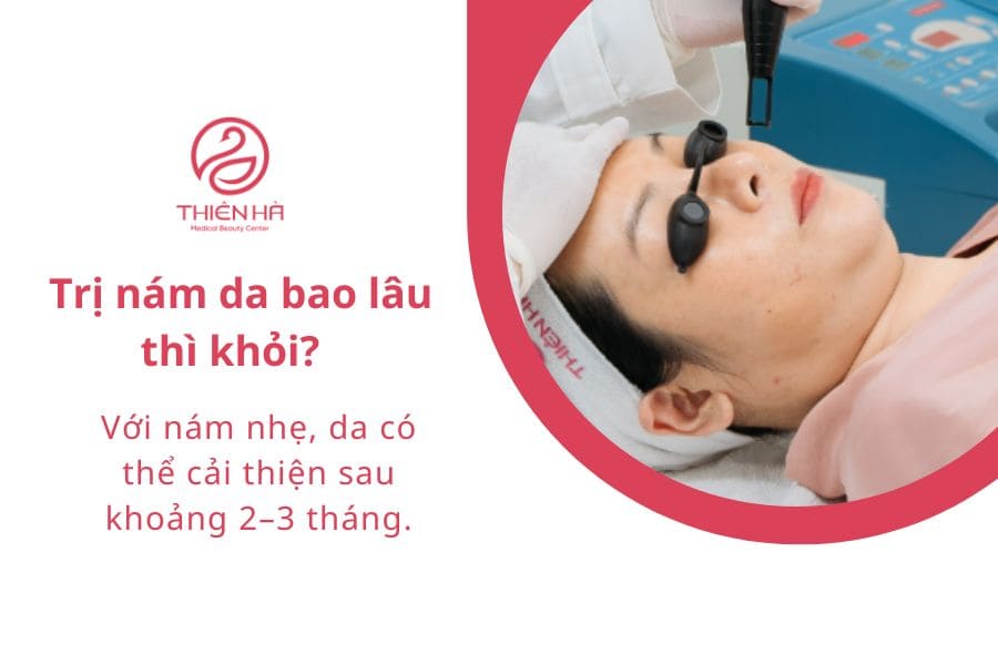 Trị nám da bao lâu thì khỏi?