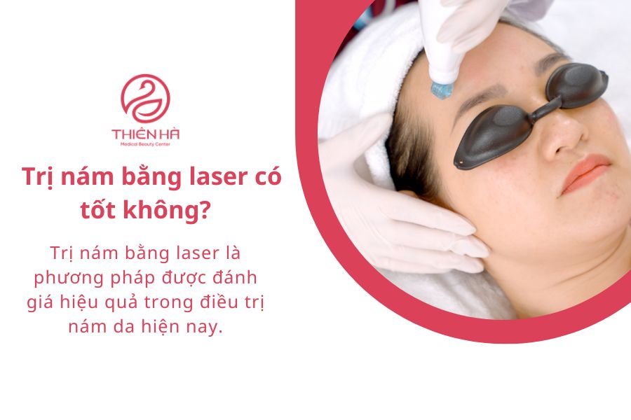 Trị nám bằng laser bao nhiêu tiền? Giá từng công nghệ mới nhất 1 Trị nám bằng laser có tốt không?