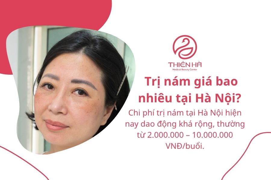 Trị nám giá bao nhiêu tại Hà Nội? 
