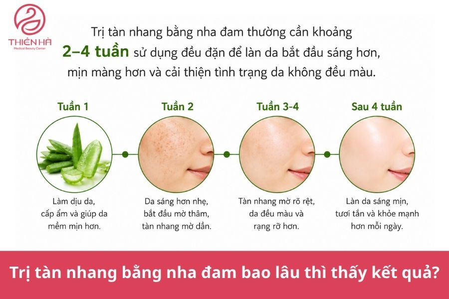 Trị tàn nhang bằng nha đam bao lâu thì thấy kết quả?