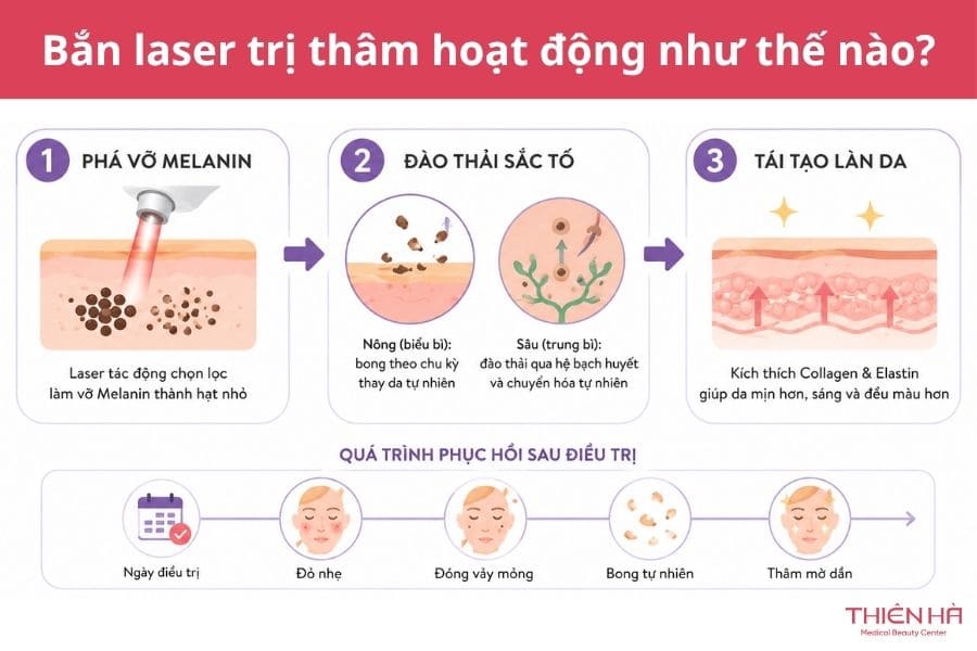 Những điều cần biết về bắn laser trị thâm 1 Bắn laser trị thâm hoạt động như thế nào?