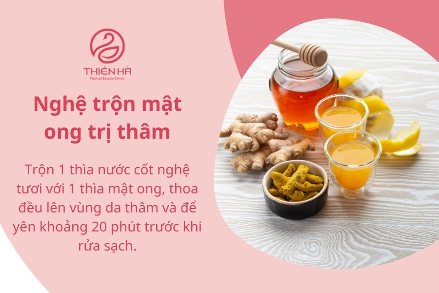Nghệ tươi khi kết hợp với mật ong sẽ tăng hiệu quả trị thâm