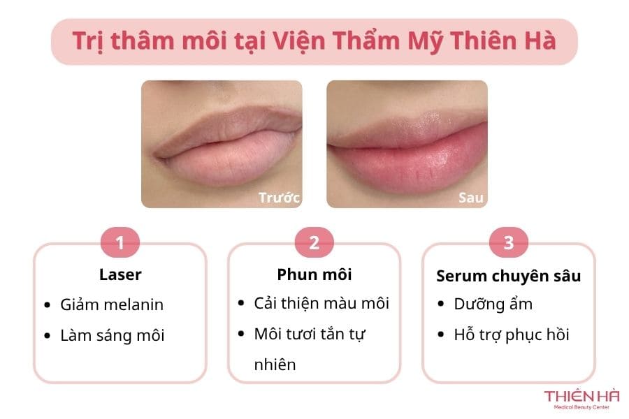 Cách trị thâm môi bằng chanh đơn giản, hiệu quả tại nhà 7 Các liệu trình trị thâm môi bằng công nghệ cao tại Thiên Hà