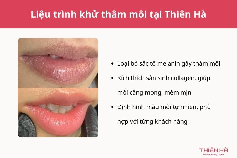 Nếu môi đã bị thâm lâu năm, hãy thử can thiệp y khoa nhé!