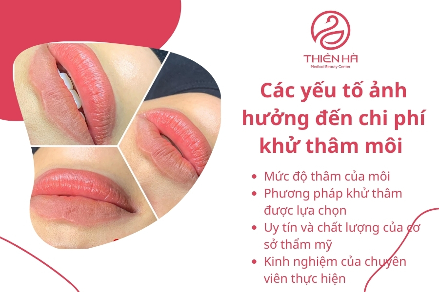 Các chi phí cơ bản ảnh hưởng đến giá khử thâm môi 