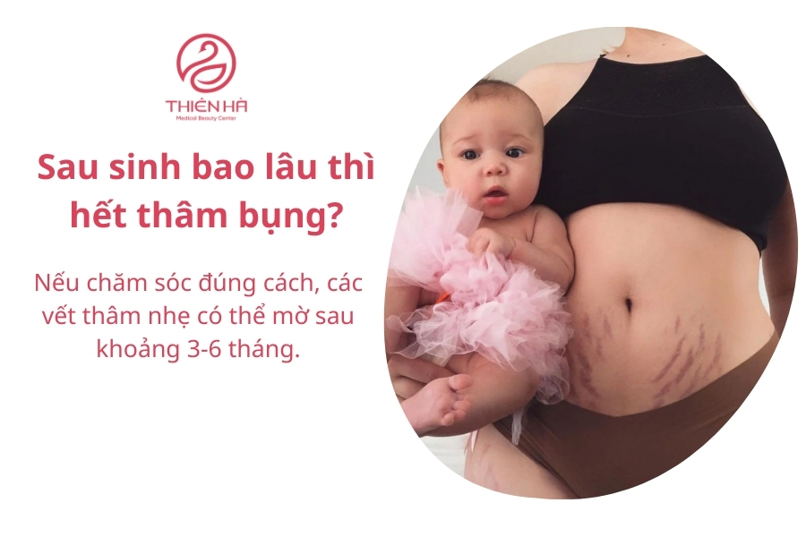 Vết thâm sau sinh có thể tự hết những cần nhiều thời gian 