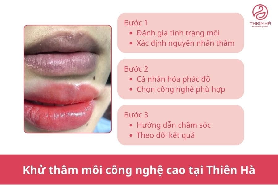 Môi bị thâm tím: Vì sao xảy ra và làm sao để cải thiện? 8 Giải pháp khử thâm môi công nghệ cao tại Thẩm mỹ viện Thiên Hà