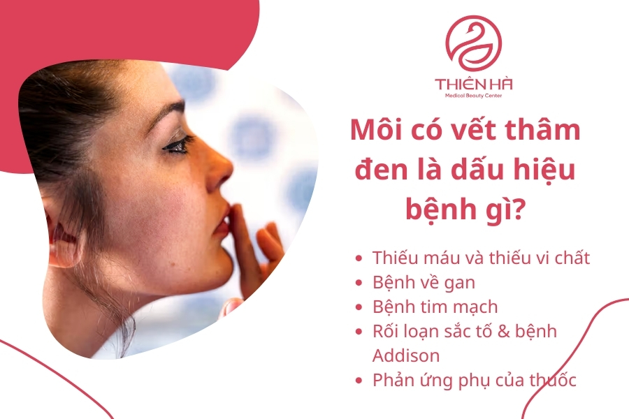 Nếu bạn nhận thấy môi có vết thâm đen kéo dài hoặc đi kèm với các triệu chứng bất thường khác, hãy đến cơ sở y tế để kiểm tra và tìm hướng điều trị kịp thời. 