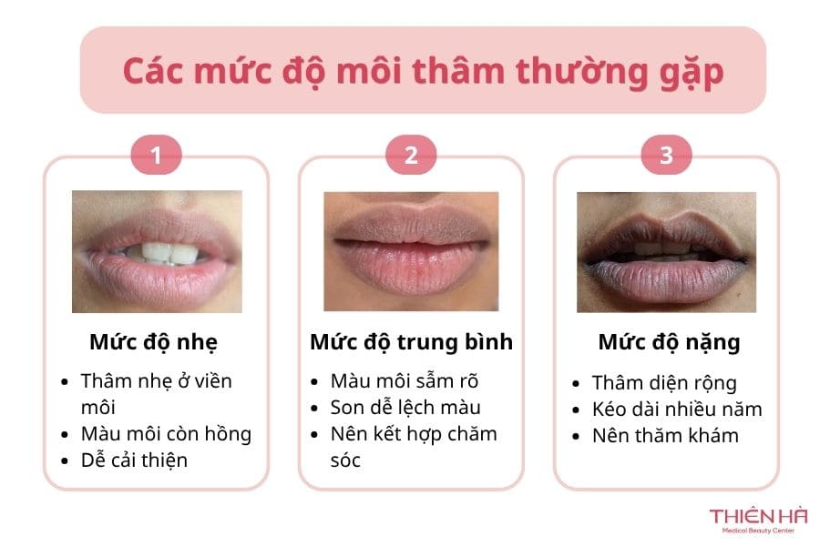 Phân biệt các mức độ môi thâm thường gặp để lựa chọn phương pháp điều trị đúng